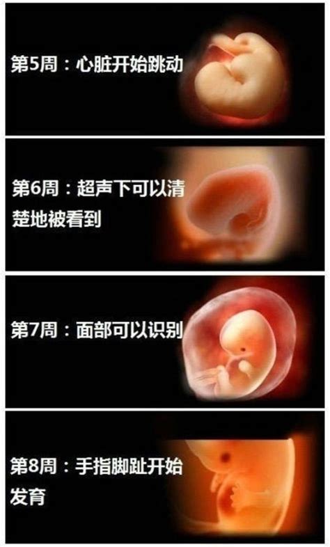 怀孕4个月胎儿图