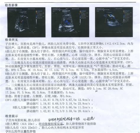 胎儿心脏缺损什么意思