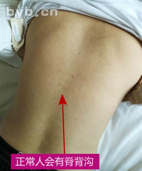 乳房发育不良挂什么科