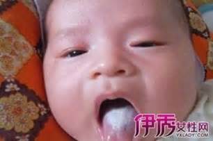 怎样从舌苔来判断宝宝的健康