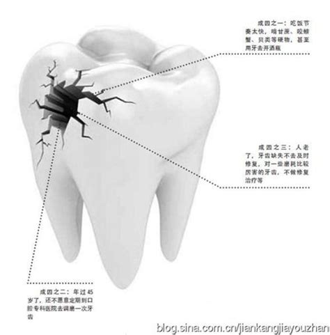 牙槽突裂手术时间