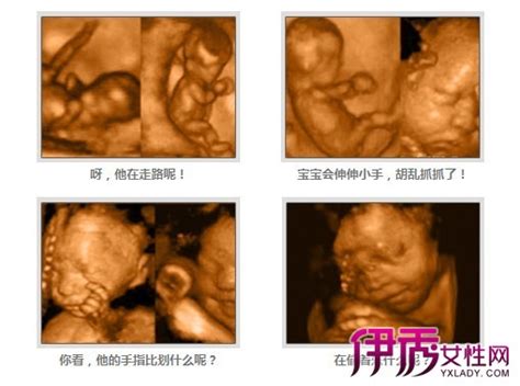 16周彩超胎儿图