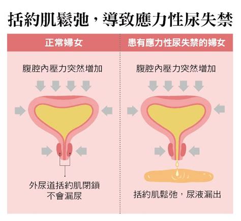 卵子质量不好的原因有哪些