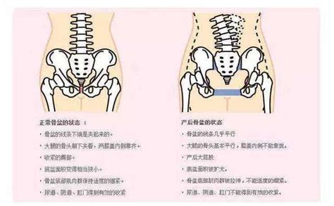 女性盆底肌肉松弛的修复动作图片