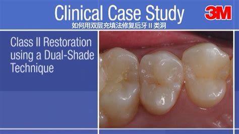 留学去日本 口腔技工 或 口腔修复工 有谁知道 帮帮小弟 正在日本留学 学这个专业的更好了 或 留下你们的QQ