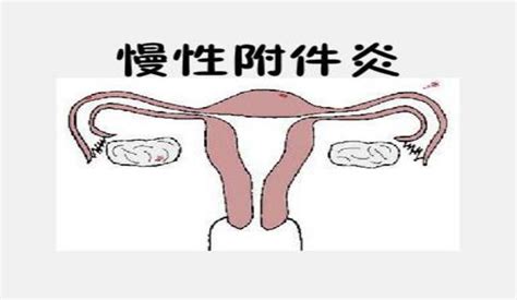 孕妇尿道炎有什么症状