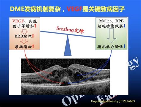 流产后长斑是因为什么