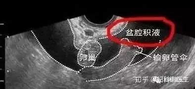 b超子宫大小是什么意思
