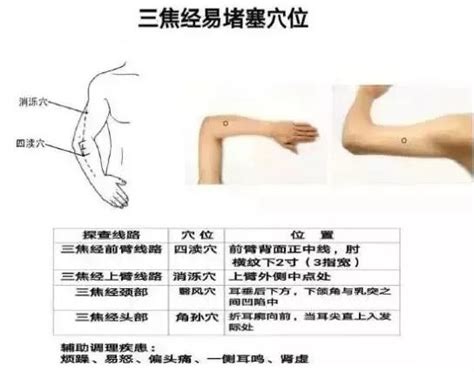 淤堵的经络刚开始针灸时更疼