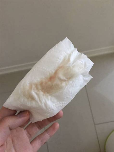 试管移植着床白带颜色