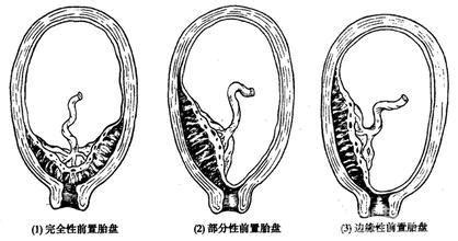 13周胎盘厚度正常范围