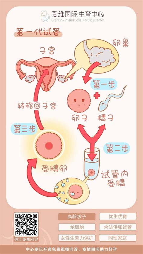 宫内孕和宫外孕有什么区别感觉