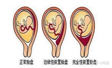 15周胎儿在腹中位置