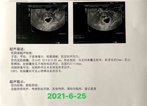 孕五月肚子颤抖正常吗