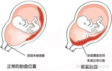 孕中期注意事项及禁忌