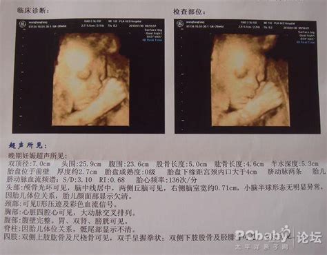 孕24周的宝宝四维彩超图片