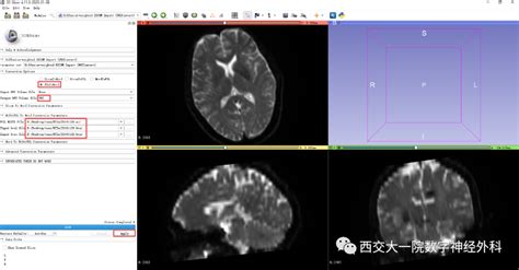 DICOM的标准具体内容?