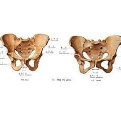 左侧髋臼及耻骨联合上有小骨岛