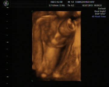 怀孕20周胎儿有多大