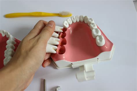 大牙做固定假牙