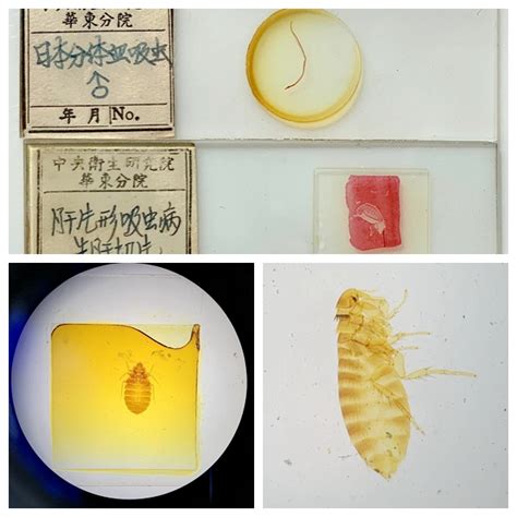 寄生虫虫标本切片 寄生虫切片 光辉网络