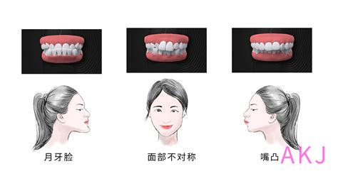 牙齿不良习惯矫正器是什么