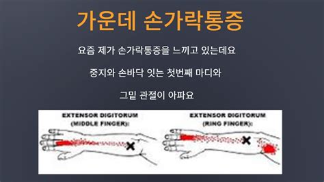 하정우 가운데손가락