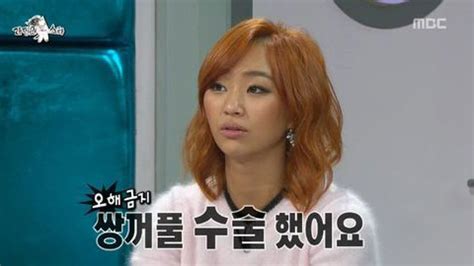 하정우 쌍수
