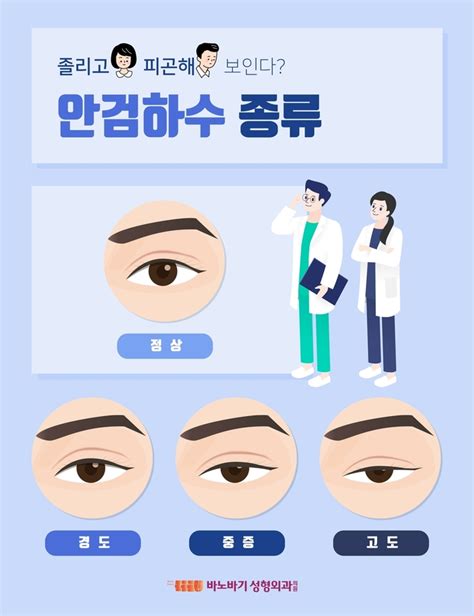 하정우 안검하수